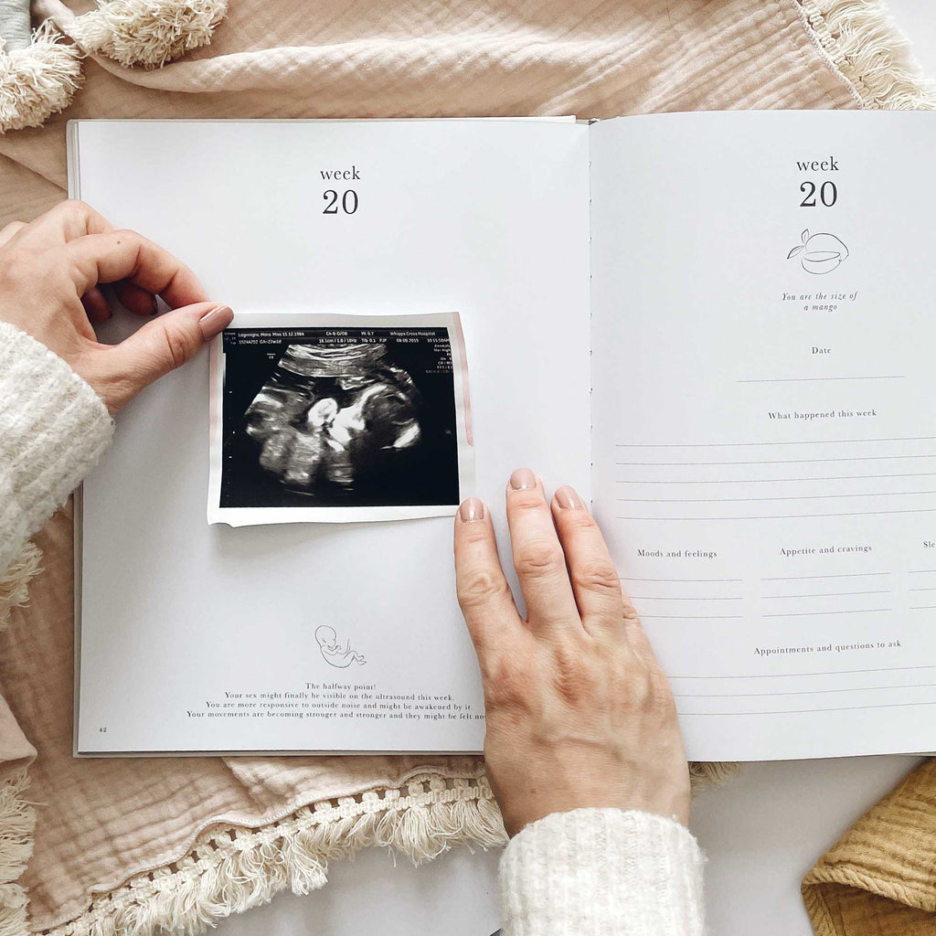 Blush & Gold -My Pregnancy Journal - Safari with Gilded Edges